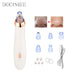 Electric Blackhead Remover & Pore Cleaner