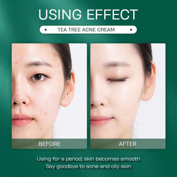 Clear Skin Tea Tree Cream